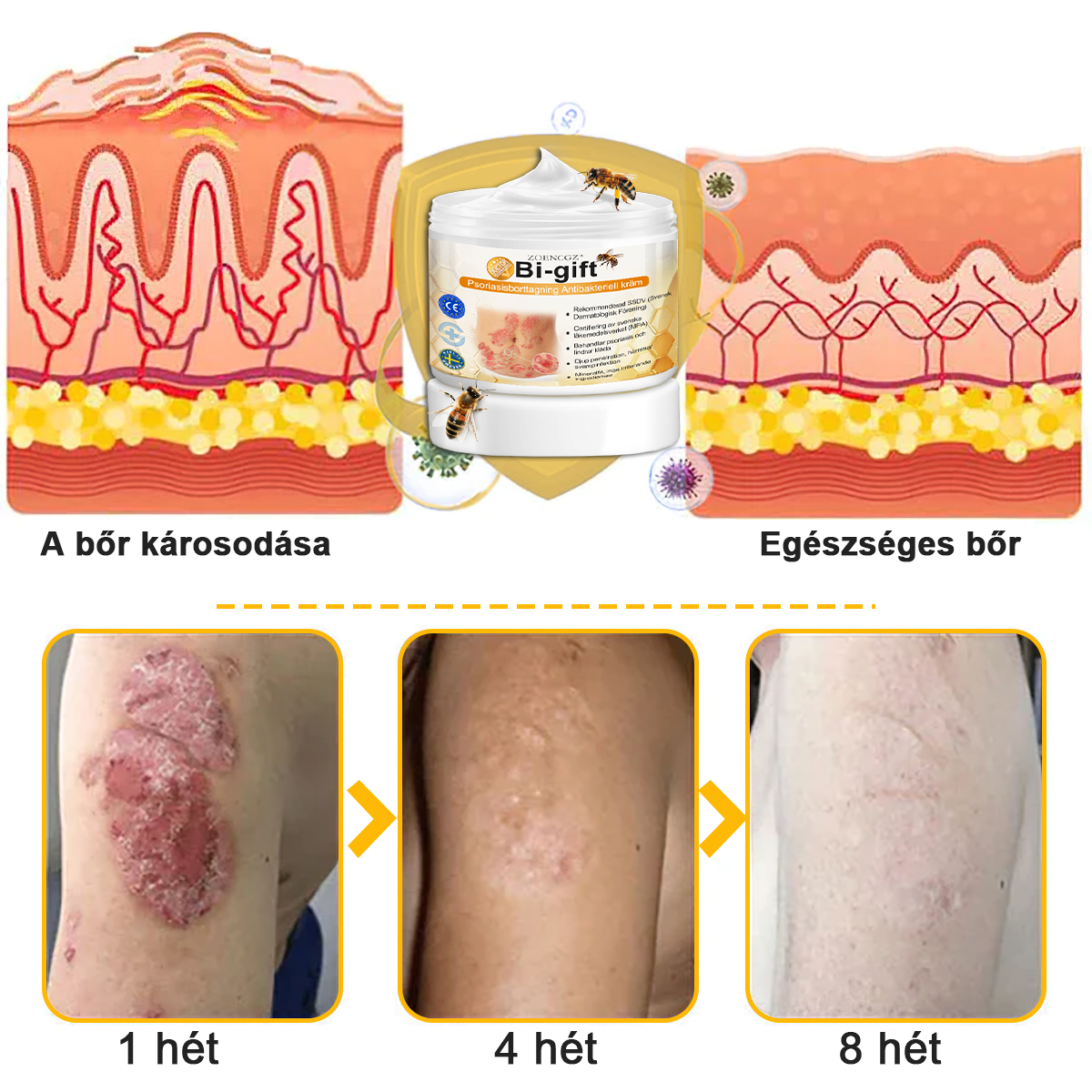 đ©ââïžđZoencgzâą mĂ©hmĂ©reg pikkelysömör eltĂĄvolĂtĂł krĂ©mđ„ (Az SSDV Skin Institute ajĂĄnlĂĄsa)