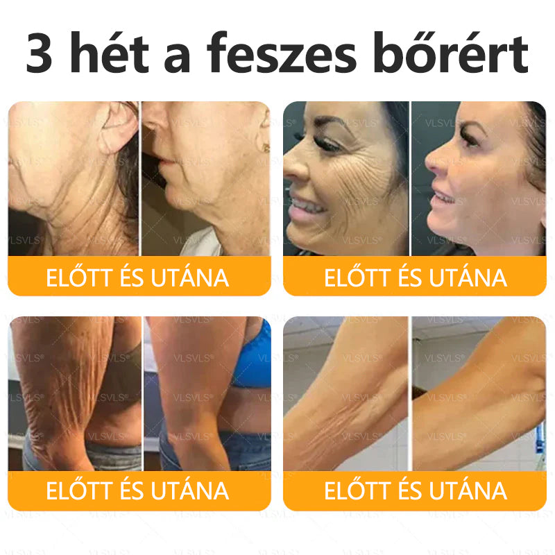 💐🌟💐Magyarországon készült és szállítva✨ VLSVLS® Méhméreg Bőrjavító Krém🔥 Utolsó nap 80% kedvezmény