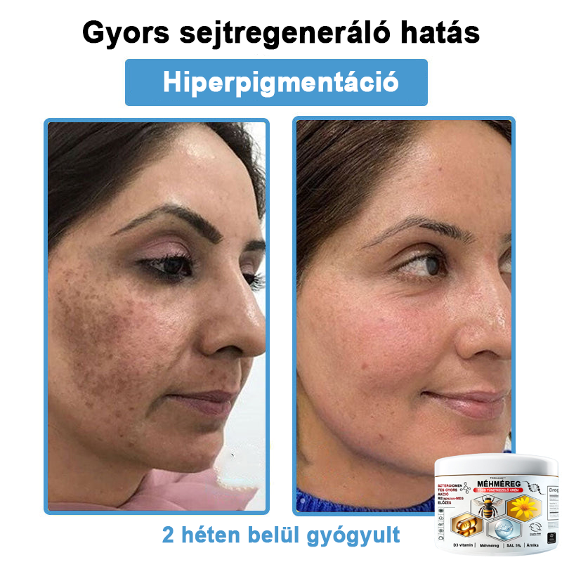TODAHOF™✨ Multi-Symptoms krém méhméreggel (👩⚕️ az EMA ajánlásával)