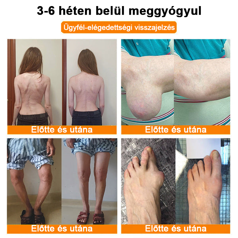 ✅Hivatalos Áruház: Ourlyard™ Magnézium Olaj és Méhméreg ízületjavító spray 👨⚕️ A Gyógyszerügyi Hivatal (OGYEI) jóváhagyásával🔥🔥🔥