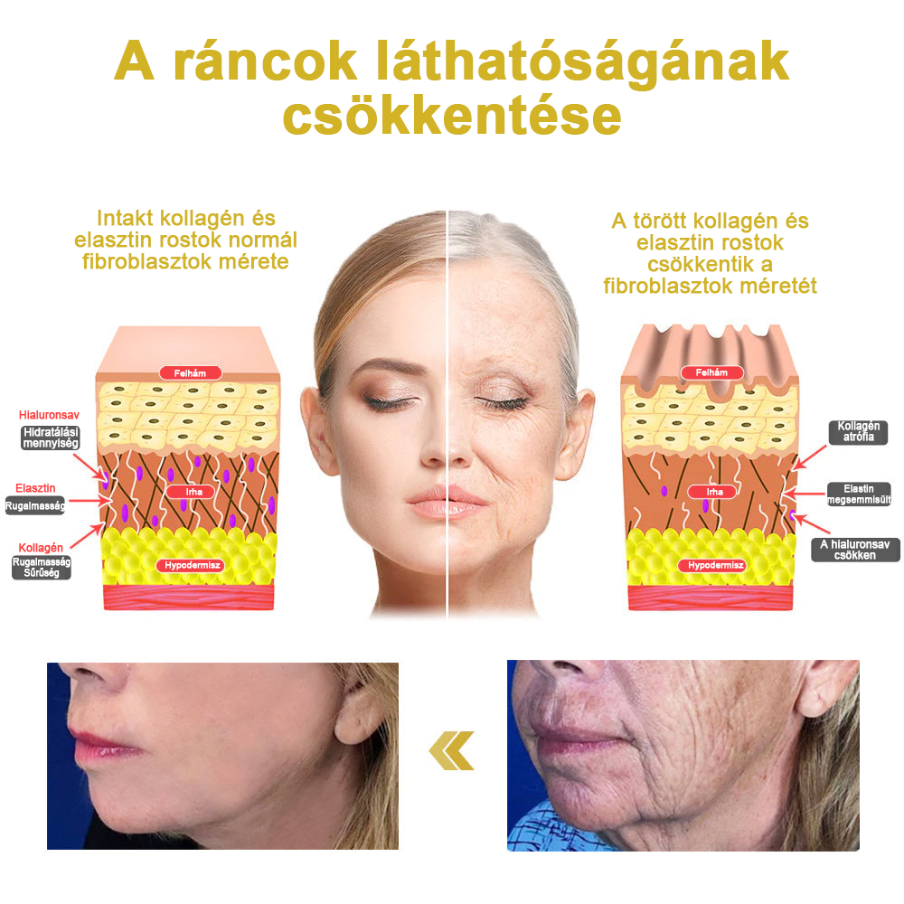 💃🧑⚕️Utolsó napi kedvezmény: 75% 0FF Ceoerty™advanced feszesítő és ránctalanító krém: visszaállítja a bőr rugalmasságát🌐
