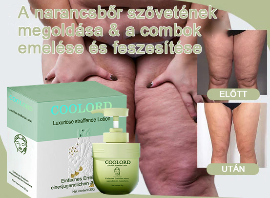 đ đđđšđšđ„đšđ«đâą Luxus kollagĂ©n feszesĂtĆ krĂ©m (minden nĆ szĂĄmĂĄra)
