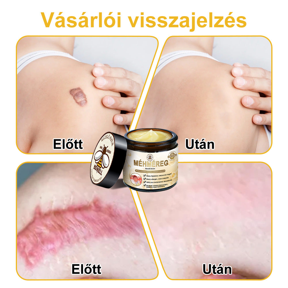 🐝✨𝑩𝑺𝑾𝑬𝑳𝑳® 𝑴é𝒉𝒎é𝒓𝒆𝒈 𝑲𝒆𝒛𝒆𝒍é𝒔 𝑲𝒓é𝒎👨⚕️(𝑫𝒆𝒓𝒎𝒂𝒕𝒐𝒍ó𝒈𝒖𝒔 𝒂𝒋á𝒏𝒍á𝒔𝒐𝒌) (🔥𝒖𝒕𝒐𝒍𝒔ó 𝒏𝒂𝒑 𝒑𝒓𝒐𝒎ó𝒄𝒊ó 80% 𝒌𝒊)