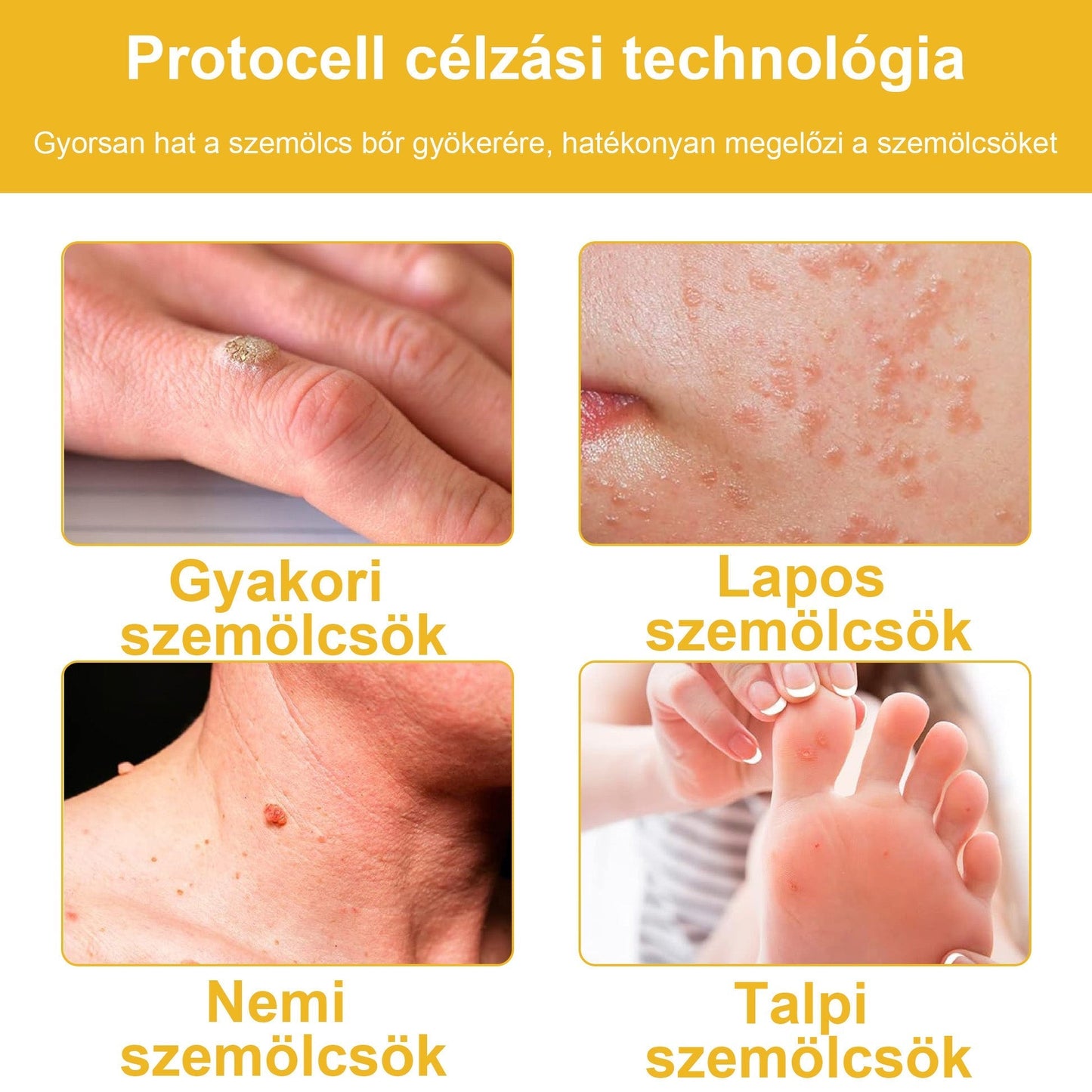 🐝✨𝑩𝑺𝑾𝑬𝑳𝑳® 𝑴é𝒉𝒎é𝒓𝒆𝒈 𝑲𝒆𝒛𝒆𝒍é𝒔 𝑲𝒓é𝒎👨⚕️(𝑫𝒆𝒓𝒎𝒂𝒕𝒐𝒍ó𝒈𝒖𝒔 𝒂𝒋á𝒏𝒍á𝒔𝒐𝒌) (🔥𝒖𝒕𝒐𝒍𝒔ó 𝒏𝒂𝒑 𝒑𝒓𝒐𝒎ó𝒄𝒊ó 80% 𝒌𝒊)