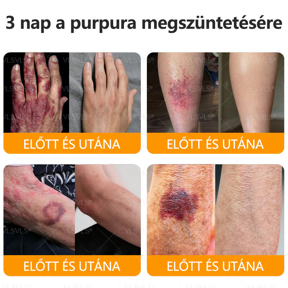 💐🌟💐Magyarországon készült és szállítva✨ VLSVLS® Méhméreg Bőrjavító Krém🔥 Utolsó nap 80% kedvezmény