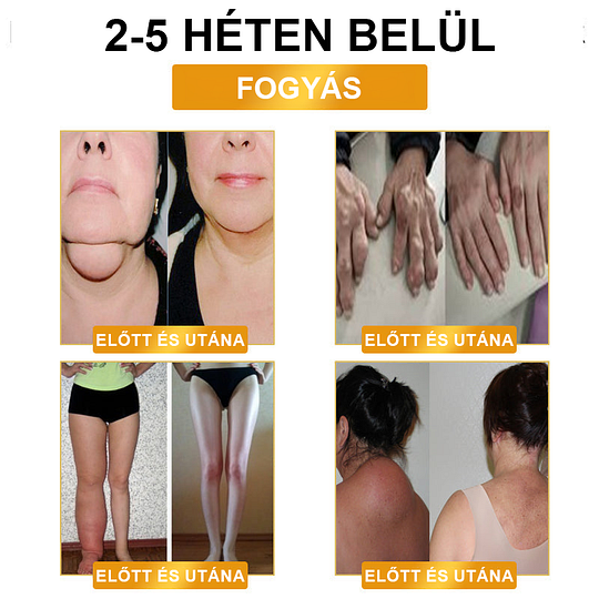 【 ⭐ utánvétel (COD) ⭐ 】𝐉𝐎𝐒𝐅𝑰𝐓™ ultrahangos zsírfúvás és távoli infravörös vércukorszint-kiegyenlítő méregtelenítő csuklópánt - Energy Balance 🔥 Korlátozott idejű akció 🔥