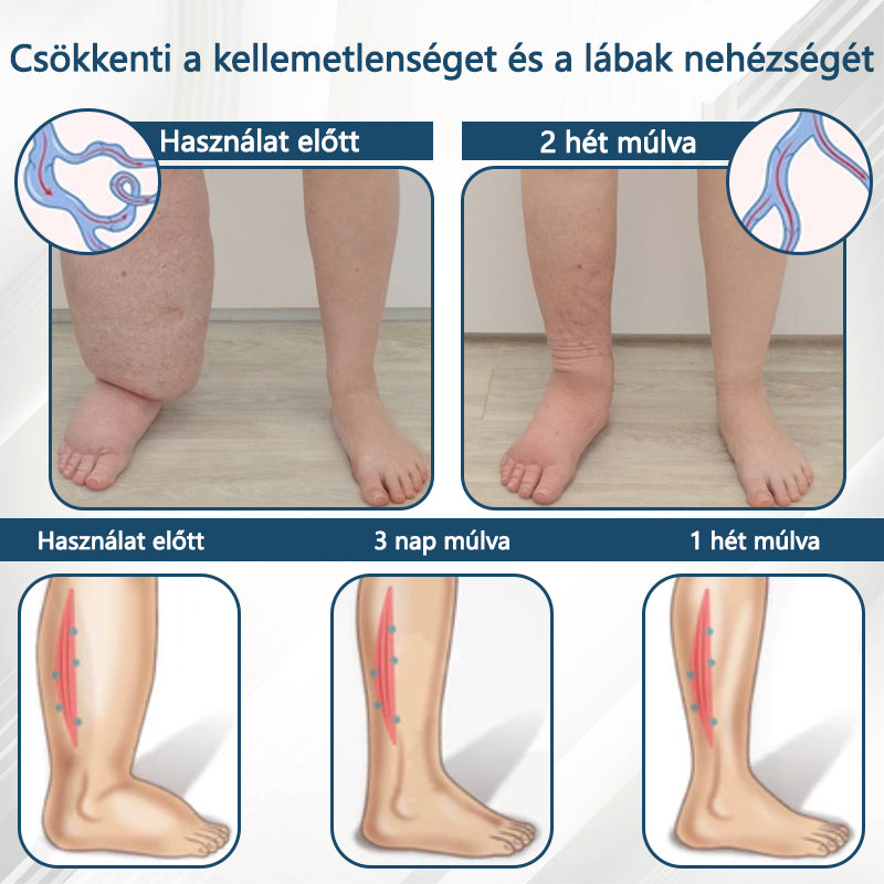 💧ATTDX® Növényi ödéma enyhítő krém nigellával