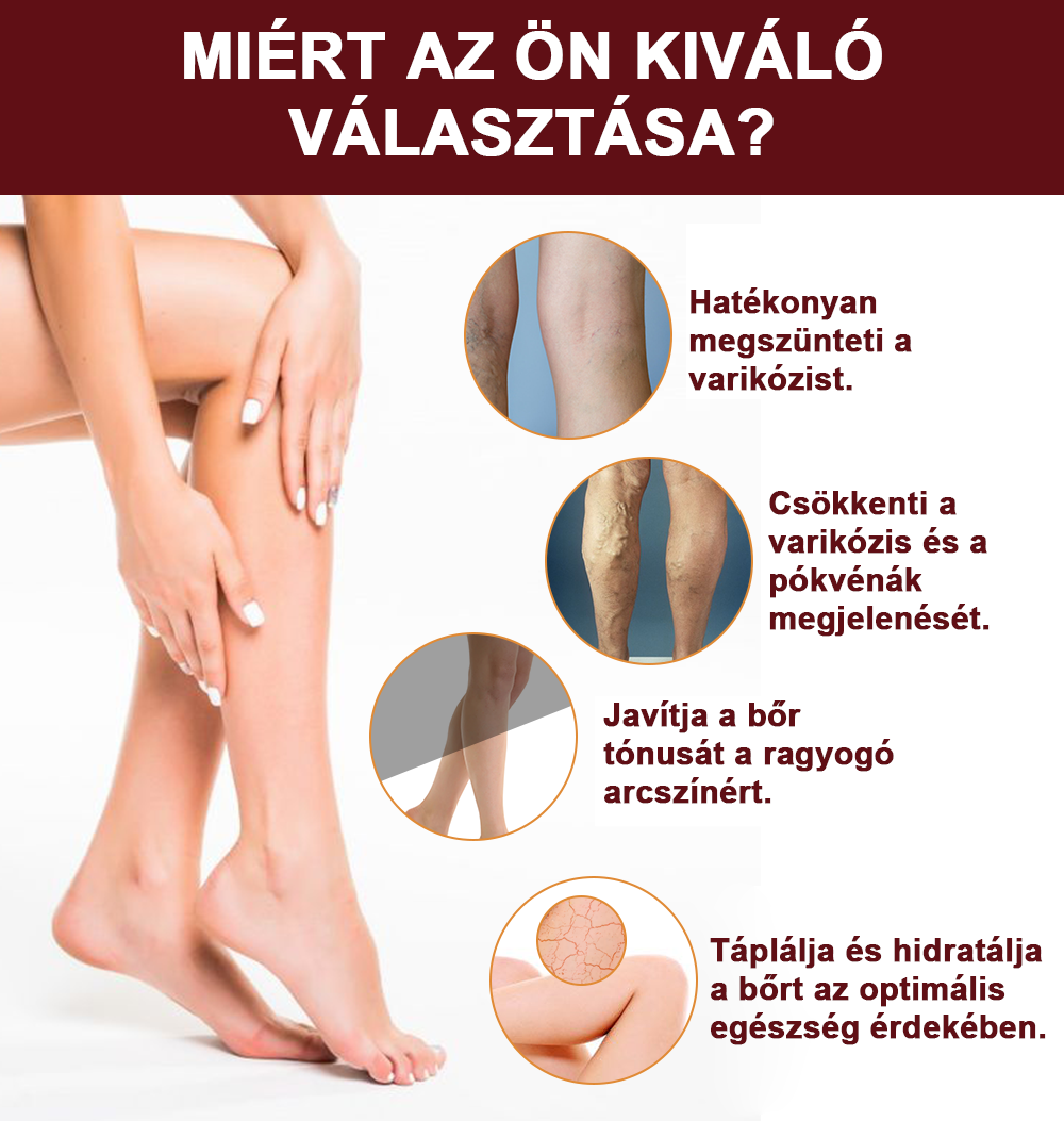 🏥 Furzero™ Pióca visszérkrém (az SSDV Skin Institute által ajánlott)