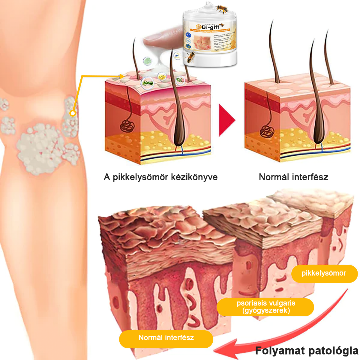 đ©ââïžđZoencgzâą mĂ©hmĂ©reg pikkelysömör eltĂĄvolĂtĂł krĂ©mđ„ (Az SSDV Skin Institute ajĂĄnlĂĄsa)
