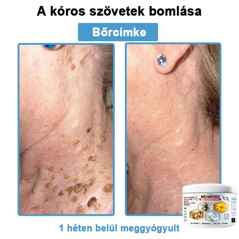 TODAHOF™✨ Multi-Symptoms krém méhméreggel (👩⚕️ az EMA ajánlásával)