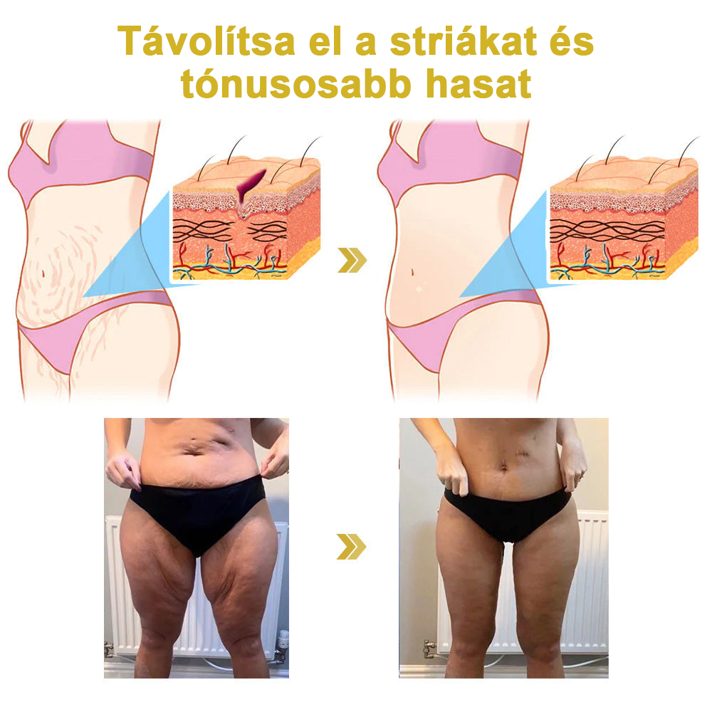 💃🧑⚕️Utolsó napi kedvezmény: 75% 0FF Ceoerty™advanced feszesítő és ránctalanító krém: visszaállítja a bőr rugalmasságát🌐