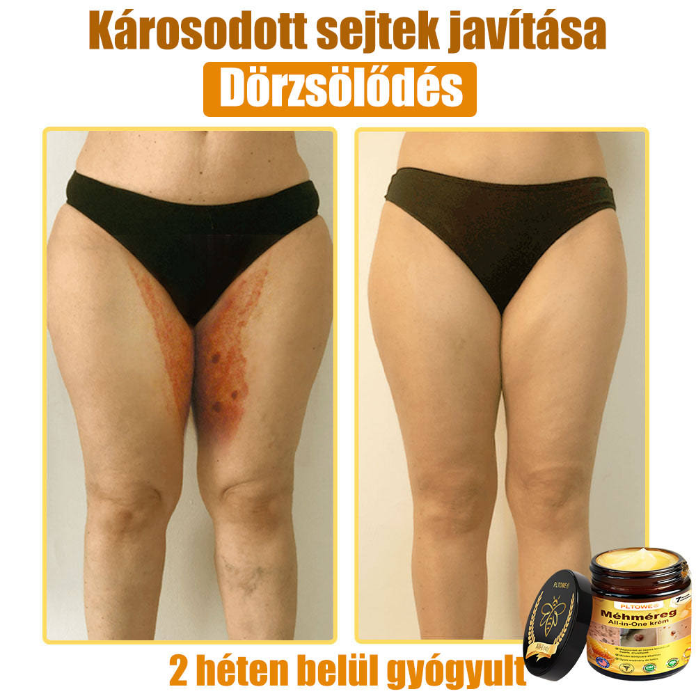 Semmelweis Egyetem által ajánlott | Hivatalos bolt | PLTOWE™ teljes testfelületet ápoló krém: öregedésgátló, hidratáló, bőrjavító, egységes bőrtónus, akne- és sötét folt kezelés, szemölcs- és anyajegy eltávolítás, pikkelysömör enyhítése
