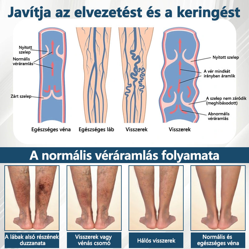 💧ATTDX® Növényi ödéma enyhítő krém nigellával