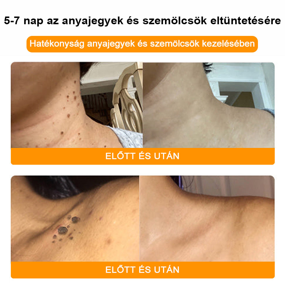 🐝✨𝑩𝑺𝑾𝑬𝑳𝑳® 𝑴é𝒉𝒎é𝒓𝒆𝒈 𝑲𝒆𝒛𝒆𝒍é𝒔 𝑲𝒓é𝒎👨⚕️(𝑫𝒆𝒓𝒎𝒂𝒕𝒐𝒍ó𝒈𝒖𝒔 𝒂𝒋á𝒏𝒍á𝒔𝒐𝒌) (🔥𝒖𝒕𝒐𝒍𝒔ó 𝒏𝒂𝒑 𝒑𝒓𝒐𝒎ó𝒄𝒊ó 80% 𝒌𝒊)