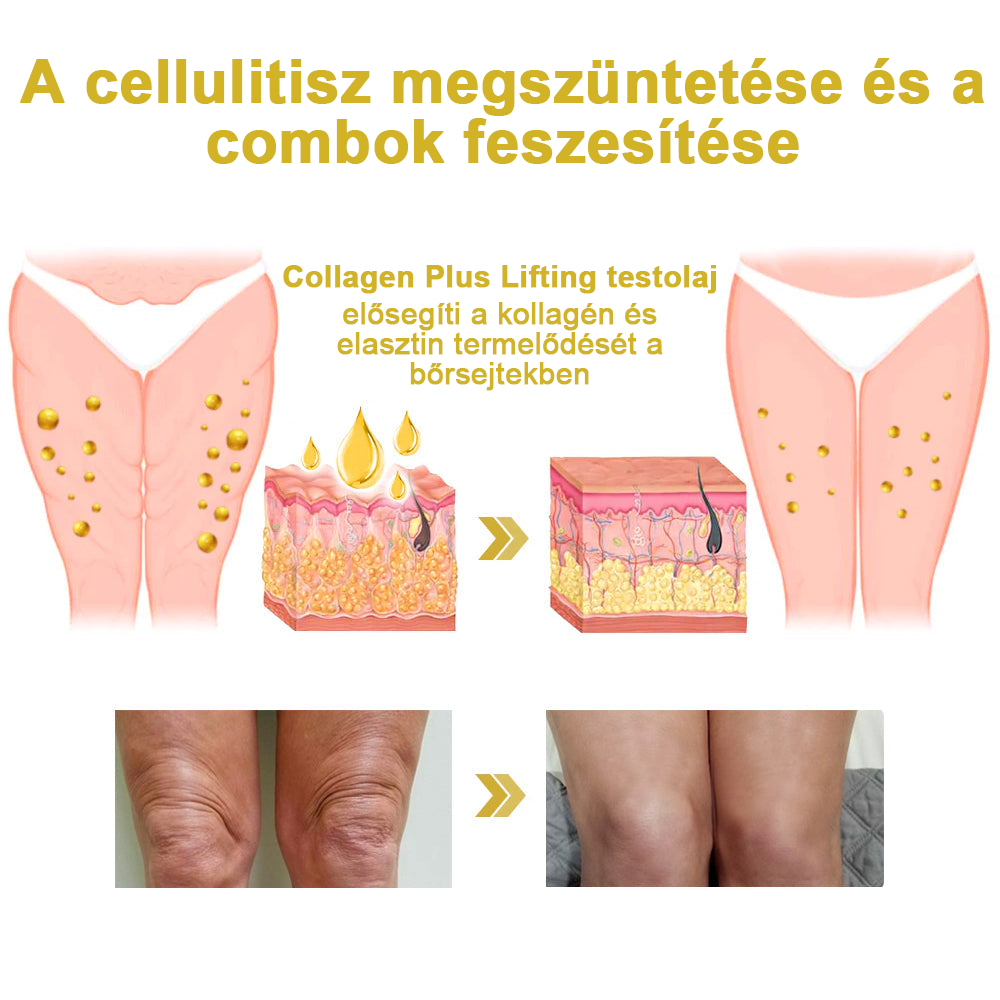 💃🧑⚕️Utolsó napi kedvezmény: 75% 0FF Ceoerty™advanced feszesítő és ránctalanító krém: visszaállítja a bőr rugalmasságát🌐