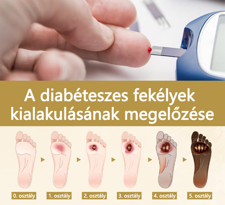 Cvreoz® méhméreg gyógyító spray a sebek gyógyulására és regenerálására a kezeken és a lábakon🎉
