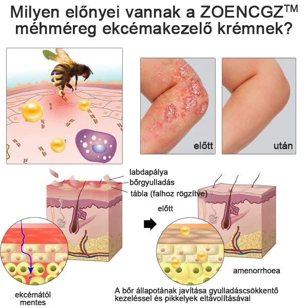 đ©ââïžđZoencgzâą mĂ©hmĂ©reg pikkelysömör eltĂĄvolĂtĂł krĂ©mđ„ (Az SSDV Skin Institute ajĂĄnlĂĄsa)