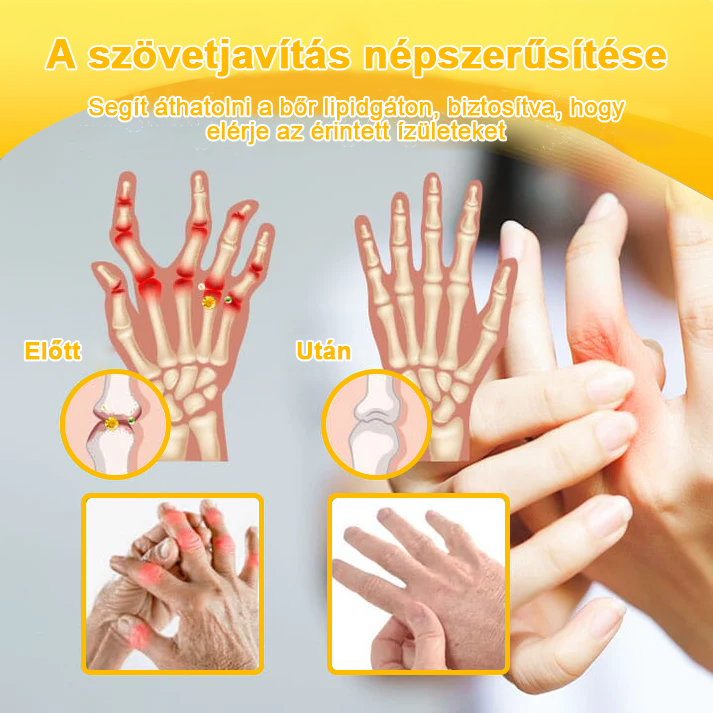 LOVILDS™ méhméreg és kurkuma ízületi gyulladás terápiás krém (👩🔬Ortopédiai betegségekre és ízületi fájdalmakra specializálódott👩🔬)