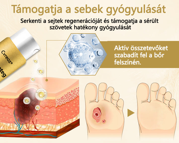 Cvreoz® méhméreg gyógyító spray a sebek gyógyulására és regenerálására a kezeken és a lábakon🎉