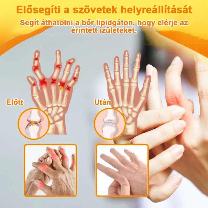 ✅Hivatalos Áruház: Ourlyard™ Magnézium Olaj és Méhméreg ízületjavító spray 👨⚕️ A Gyógyszerügyi Hivatal (OGYEI) jóváhagyásával🔥🔥🔥