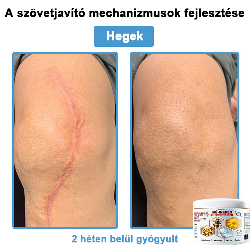 TODAHOF™✨ Multi-Symptoms krém méhméreggel (👩⚕️ az EMA ajánlásával)