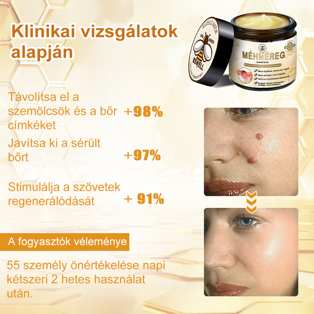 🐝✨𝑩𝑺𝑾𝑬𝑳𝑳® 𝑴é𝒉𝒎é𝒓𝒆𝒈 𝑲𝒆𝒛𝒆𝒍é𝒔 𝑲𝒓é𝒎👨⚕️(𝑫𝒆𝒓𝒎𝒂𝒕𝒐𝒍ó𝒈𝒖𝒔 𝒂𝒋á𝒏𝒍á𝒔𝒐𝒌) (🔥𝒖𝒕𝒐𝒍𝒔ó 𝒏𝒂𝒑 𝒑𝒓𝒐𝒎ó𝒄𝒊ó 80% 𝒌𝒊)