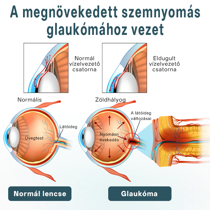 Timilk® OptiFusion Nano szemcsepp szérum🪞