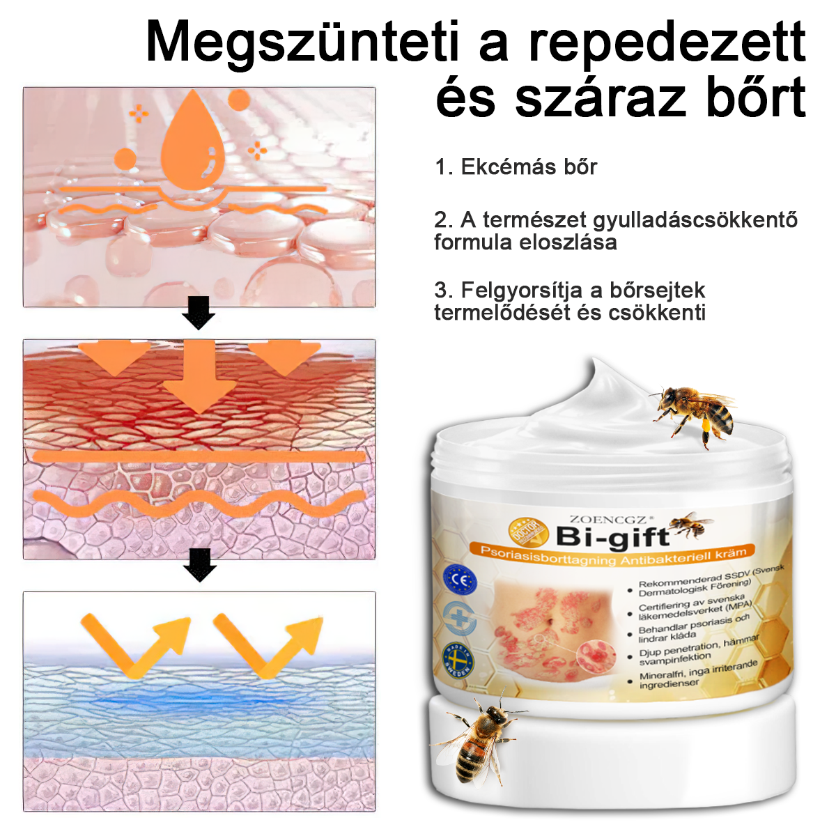 đ©ââïžđZoencgzâą mĂ©hmĂ©reg pikkelysömör eltĂĄvolĂtĂł krĂ©mđ„ (Az SSDV Skin Institute ajĂĄnlĂĄsa)