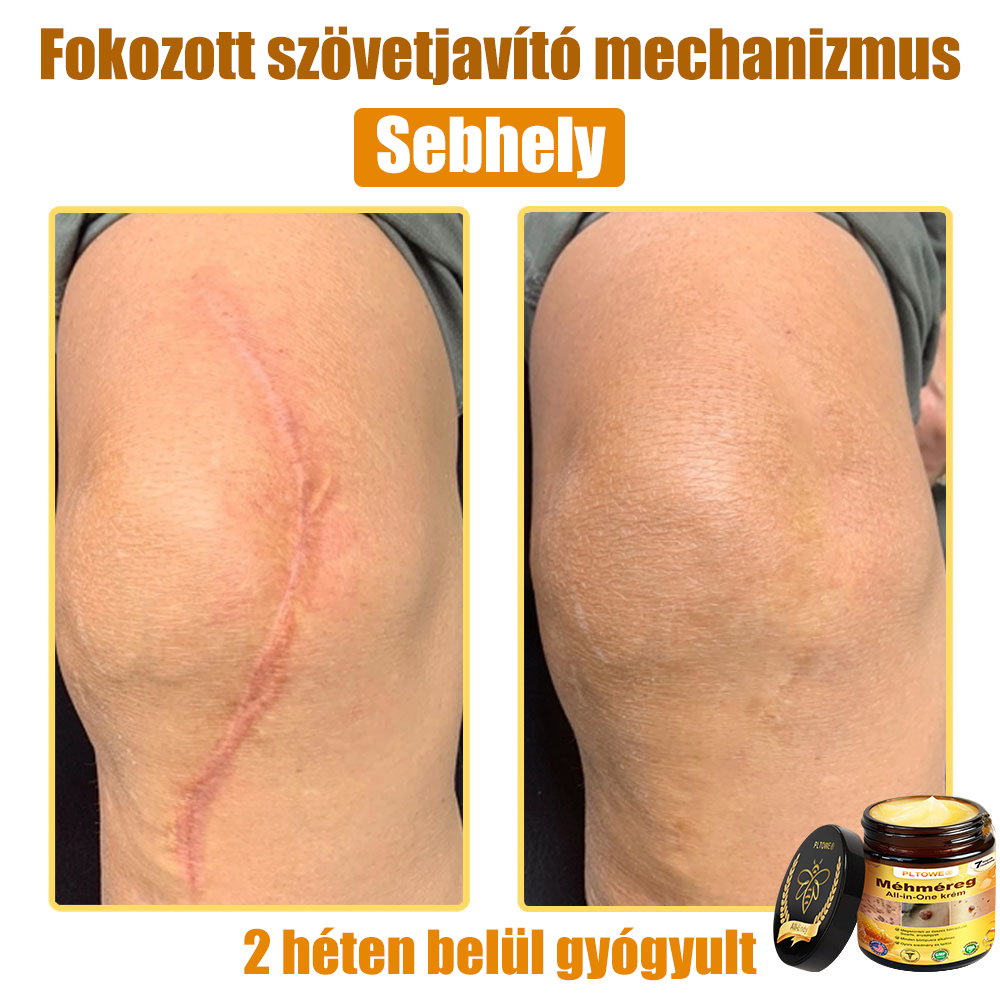 Semmelweis Egyetem által ajánlott | Hivatalos bolt | PLTOWE™ teljes testfelületet ápoló krém: öregedésgátló, hidratáló, bőrjavító, egységes bőrtónus, akne- és sötét folt kezelés, szemölcs- és anyajegy eltávolítás, pikkelysömör enyhítése