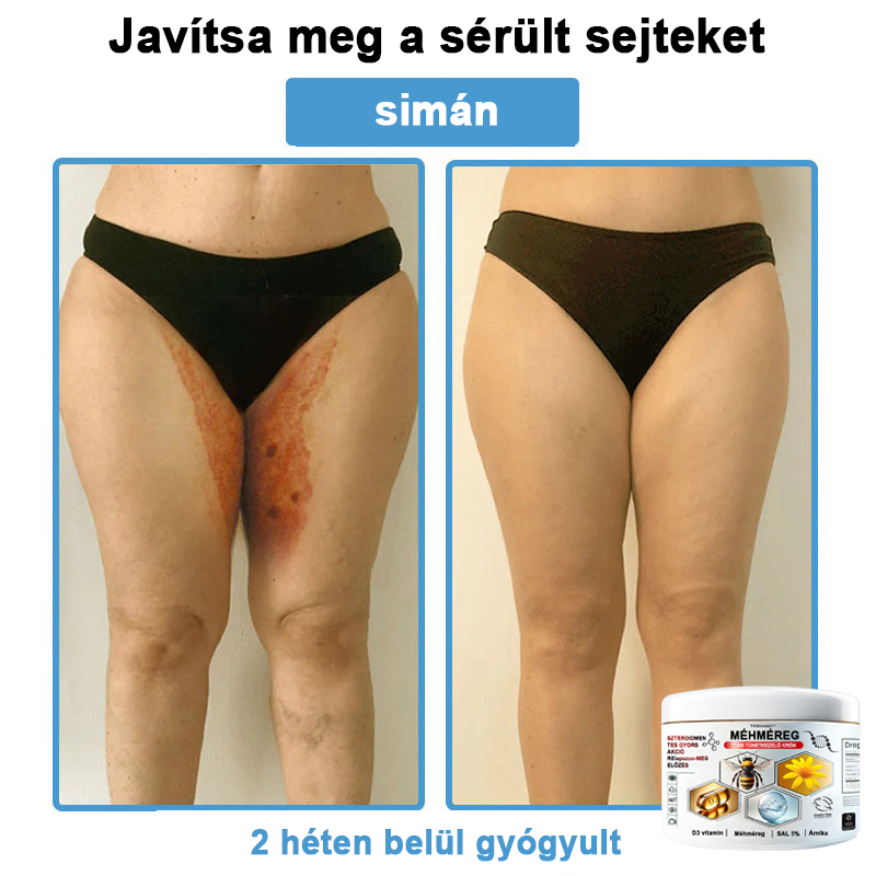 TODAHOF™✨ Multi-Symptoms krém méhméreggel (👩⚕️ az EMA ajánlásával)