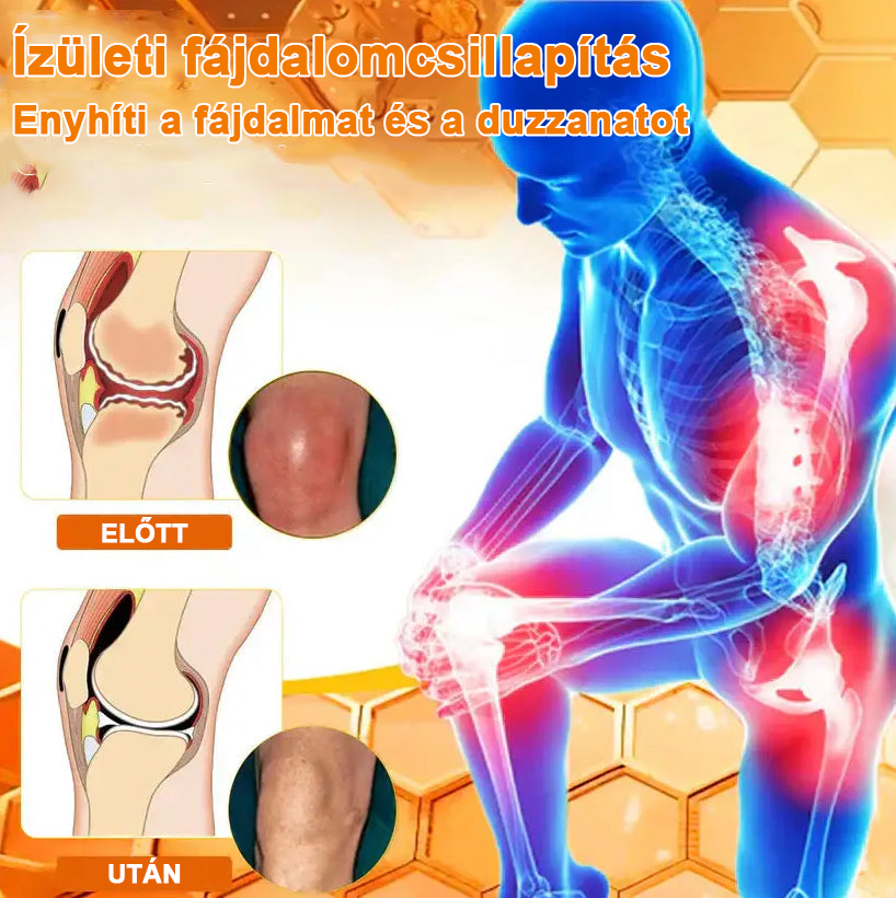 ✅Hivatalos Áruház: Ourlyard™ Magnézium Olaj és Méhméreg ízületjavító spray 👨⚕️ A Gyógyszerügyi Hivatal (OGYEI) jóváhagyásával🔥🔥🔥