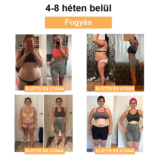 ✨【Készen áll a 2025 nyárra】𝐒𝐡𝐨𝐫𝐭𝐬™ mikrovibrációs masszázsmodul, ionos rostjavító, alakformáló rövidnadrág🌻