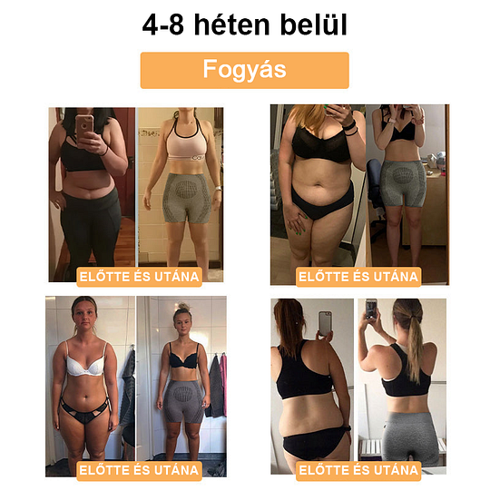 ✨【Készen áll a 2025 nyárra】𝐒𝐡𝐨𝐫𝐭𝐬™ mikrovibrációs masszázsmodul, ionos rostjavító, alakformáló rövidnadrág🌻