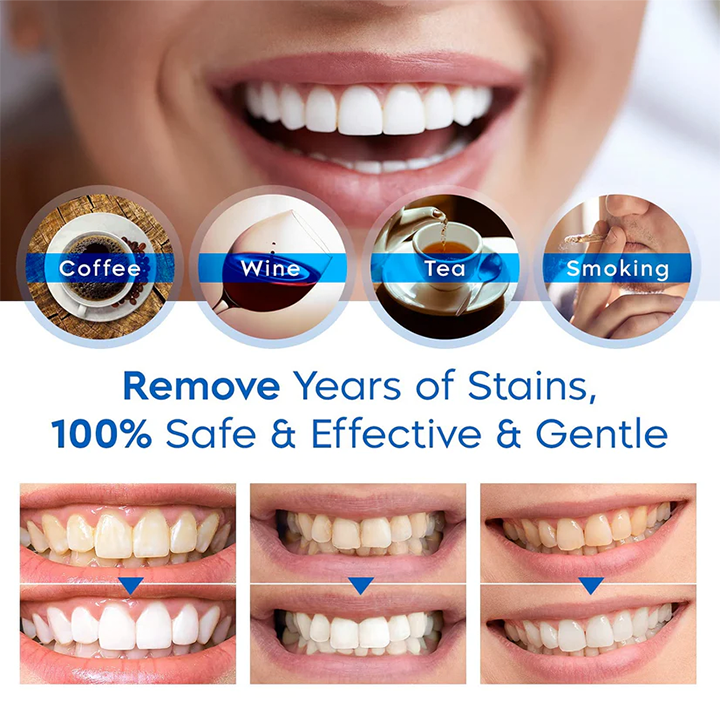 ⏳Limited Time Offer⏳LIMETOW™ Teeth Whitening Essence