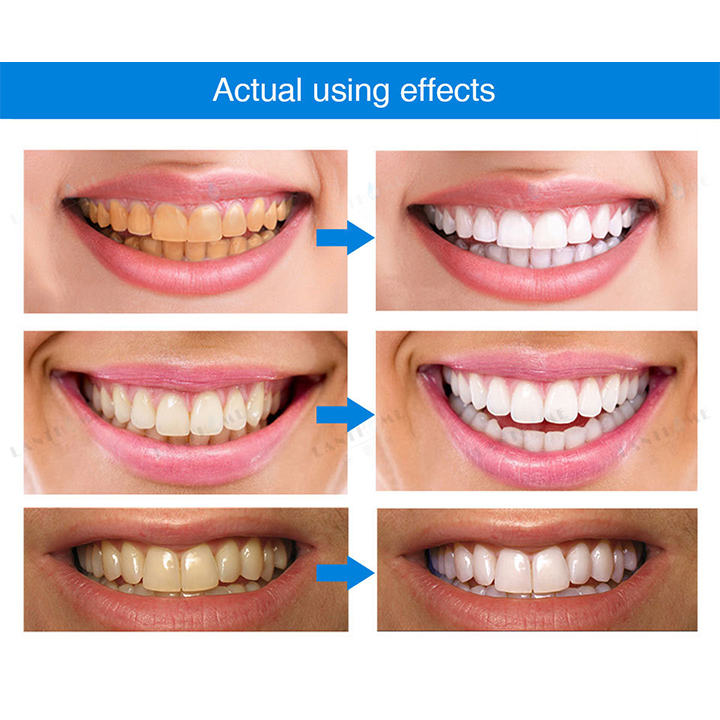 ⏳Limited Time Offer⏳LIMETOW™ Teeth Whitening Essence