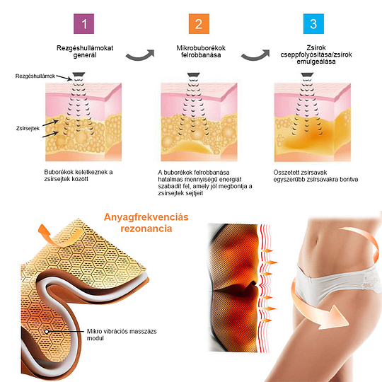 ✨【Készen áll a 2025 nyárra】𝐒𝐡𝐨𝐫𝐭𝐬™ mikrovibrációs masszázsmodul, ionos rostjavító, alakformáló rövidnadrág🌻