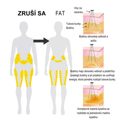 ✨🩵2024 Legújabb 𝐑𝐢𝐧𝐡𝐫𝐧𝐧™ Ultrahangos Detox zsírégető-Energy Balance karkötő⏱️ (70% kedvezmény az elmúlt napokban + orvos ajánlása)