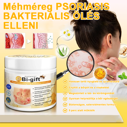👩‍⚕️🐝Zoencgz™ méhméreg pikkelysömör eltávolító krém🏥 (Az SSDV Skin Institute ajánlása)
