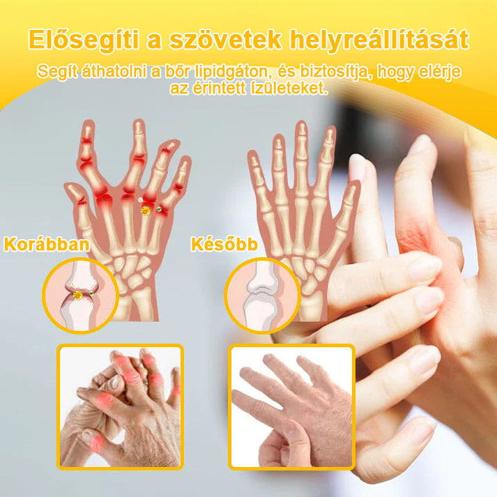 ADNOON® Botulinum Toxin & Méhméreg Fájdalomcsillapító Csontgyógyító Krém⭐👨‍⚕️A Magyar Ortopéd Társaság (MOT) Által Jóváhagyva