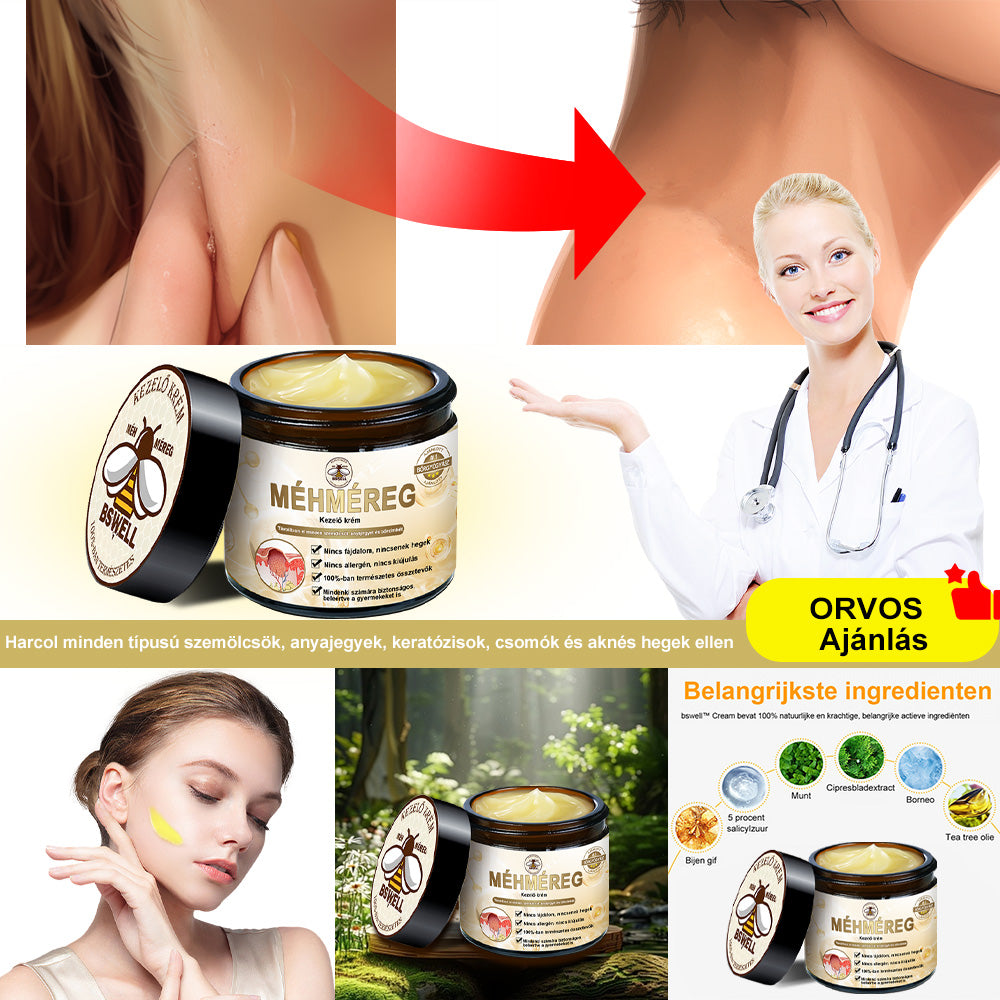 🐝✨𝑩𝑺𝑾𝑬𝑳𝑳® 𝑴é𝒉𝒎é𝒓𝒆𝒈 𝑲𝒆𝒛𝒆𝒍é𝒔 𝑲𝒓é𝒎👨‍⚕️（𝑫𝒆𝒓𝒎𝒂𝒕𝒐𝒍ó𝒈𝒖𝒔 𝒂𝒋á𝒏𝒍á𝒔𝒐𝒌） (🔥𝒖𝒕𝒐𝒍𝒔ó 𝒏𝒂𝒑 𝒑𝒓𝒐𝒎ó𝒄𝒊ó 80% 𝒌𝒊）