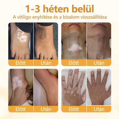 Timilk® VitiCalm méhméreg-krém🌻