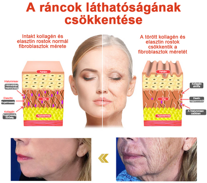 STDEI™ MÁGIKUS LUXUS TESTOLAJ (Korlátozott ideig 80% kedvezmény - Utolsó 30 perc)🌹🔥