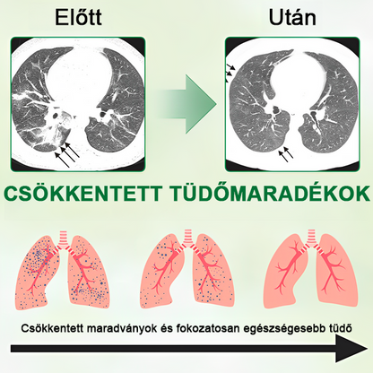 🎉【💟Készült és szállított az Egyesült Királyságban✅】👨‍⚕️𝐌𝐈𝐐𝐈𝐊𝐎® Lung Javító és ápoló inhalátorok (🌈Tüdőszakértő ajánlott🌈)