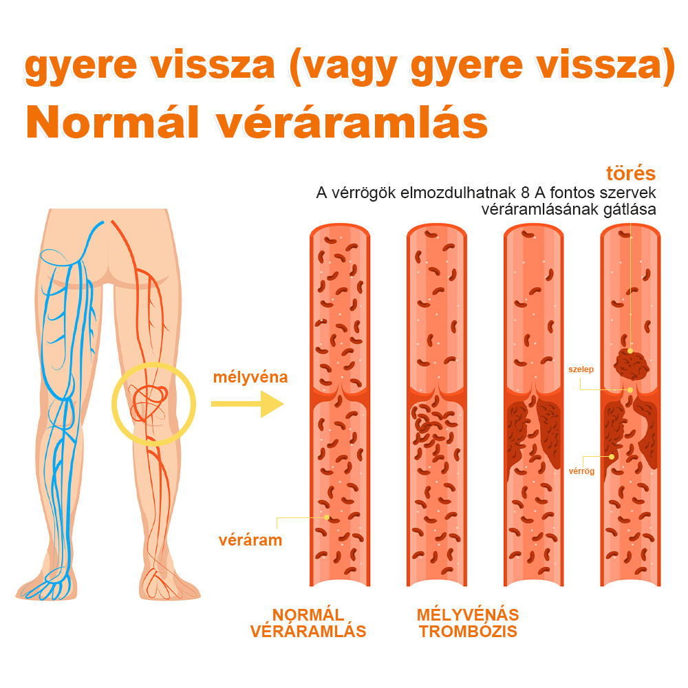 🏆🌈Zoencgz™ méhméreg ízületi gyulladás és visszér kezelő krém✨