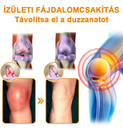 ✅Hivatalos Áruház: Ourlyard™ Magnézium Olaj és Méhméreg ízületjavító spray 👨‍⚕️ A Gyógyszerügyi Hivatal (OGYEI) jóváhagyásával🔥🔥🔥