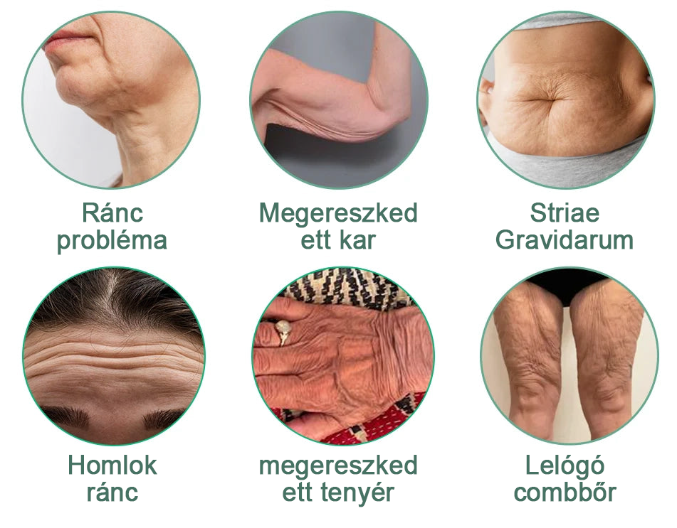 💖🥳Flysmus™ ránctalanító krém, kreppelés és megereszkedés (🔥74% kedvezmény korlátozott ideig!)