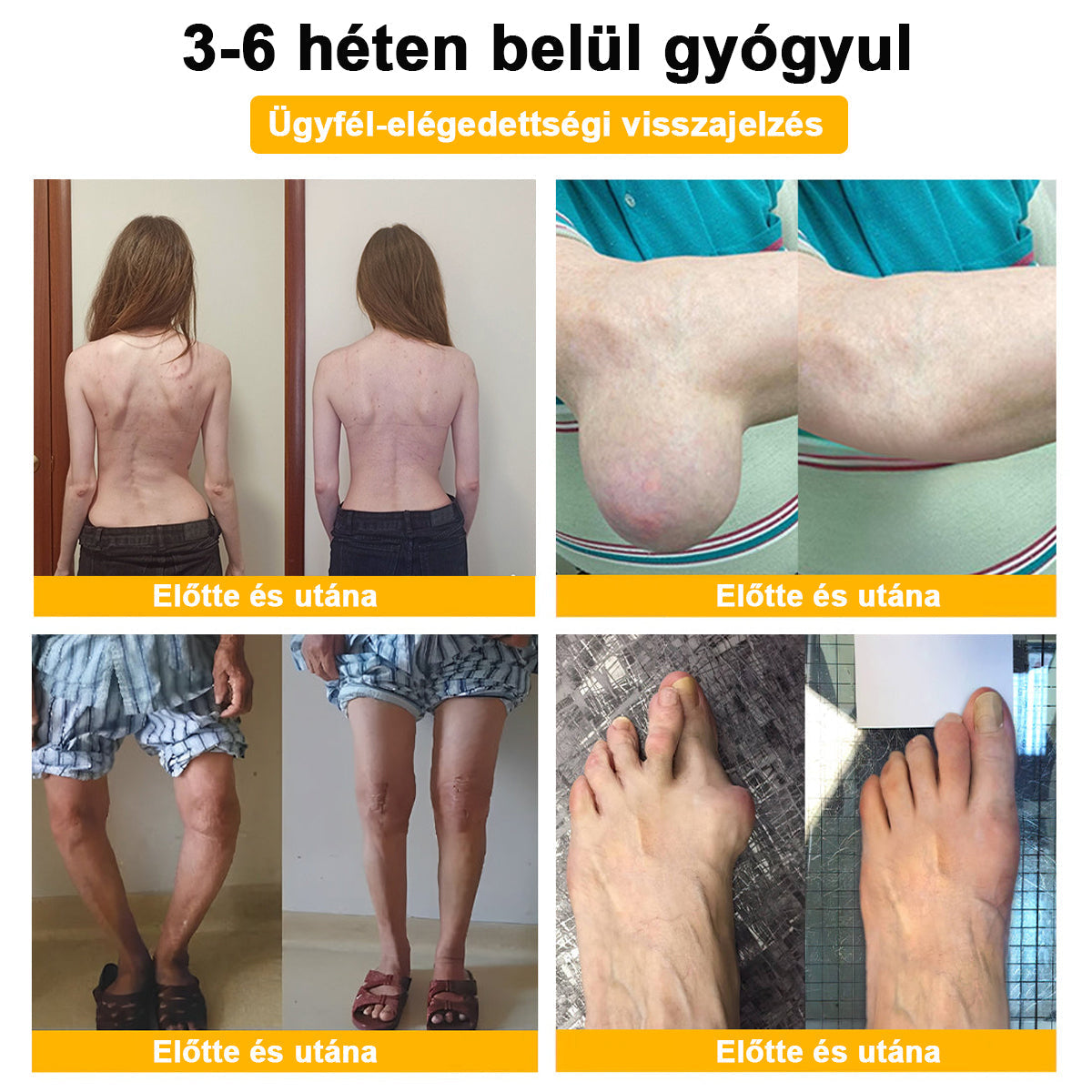 ADNOON® Botulinum Toxin & Méhméreg Fájdalomcsillapító Csontgyógyító Krém⭐👨‍⚕️A Magyar Ortopéd Társaság (MOT) Által Jóváhagyva