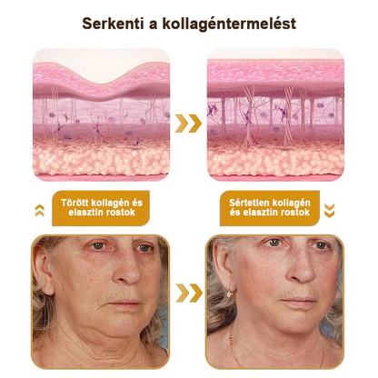 🍀Akció utolsó napja: 70% kedvezmény - ✨Furzero™ méhméreg ránctalanító krém