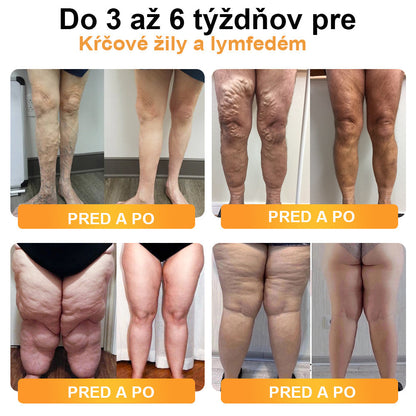 ✨🩵2024 Legújabb 𝐑𝐢𝐧𝐡𝐫𝐧𝐧™ Ultrahangos Detox zsírégető-Energy Balance karkötő⏱️ (70% kedvezmény az elmúlt napokban + orvos ajánlása)