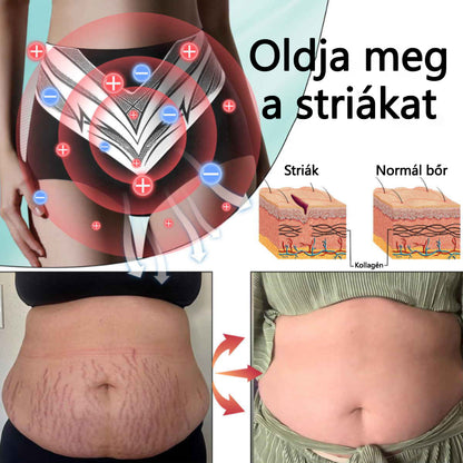 🎉 Korlátozott idejű ajánlat - hatalmas kedvezmény! 🔥 Akár 90% KEDVEZMÉNY! Sfrcord™ titánszálas önmelegedő turmalin formáló rövidnadrág✅✅
